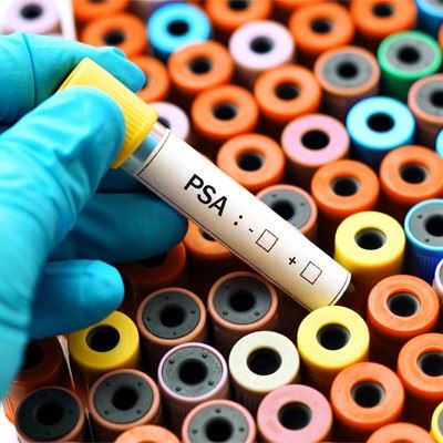 Prostate Cancer Screenings